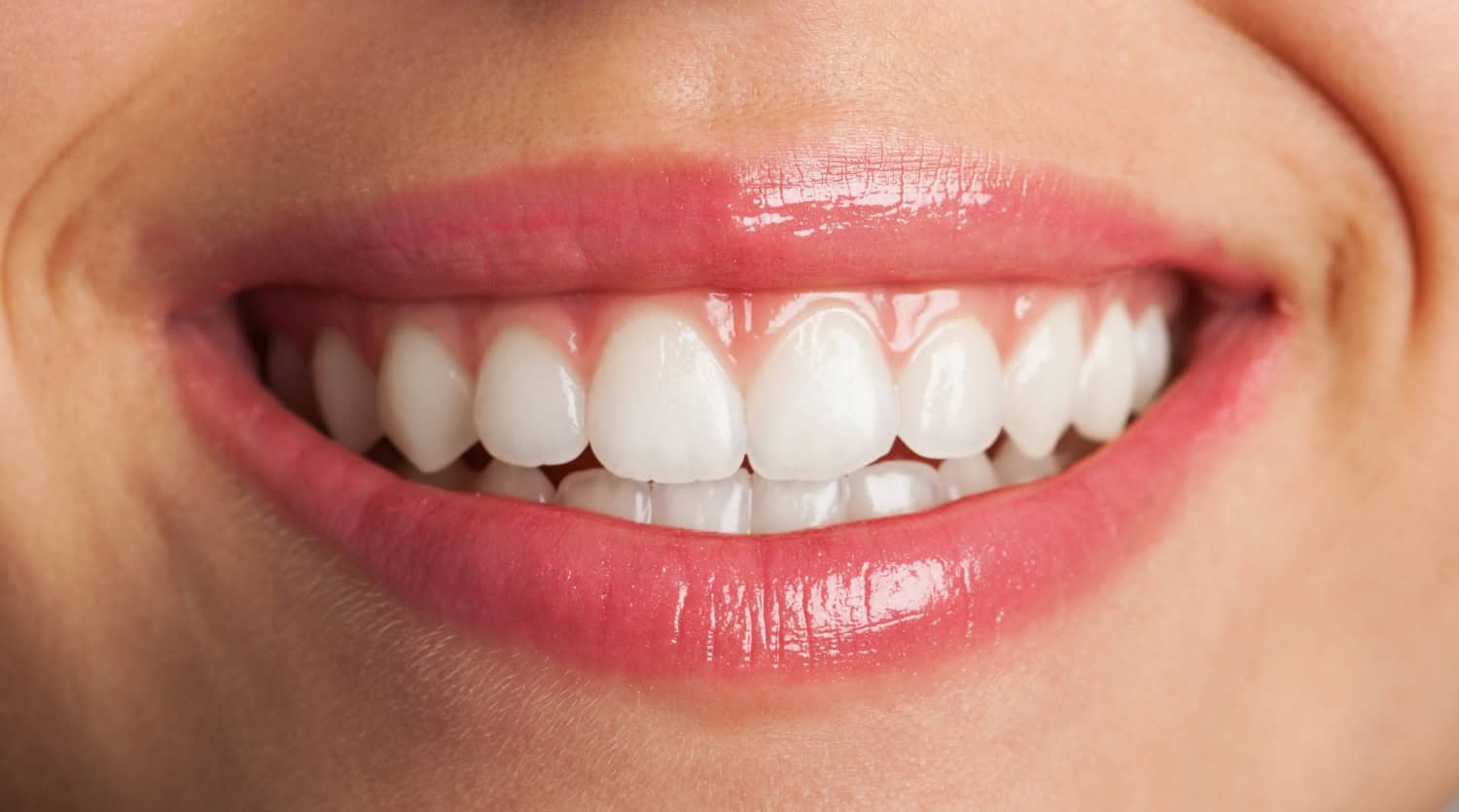 Close-up of a bright white smile with healthy teeth and pink gums after professional teeth whitening treatment.