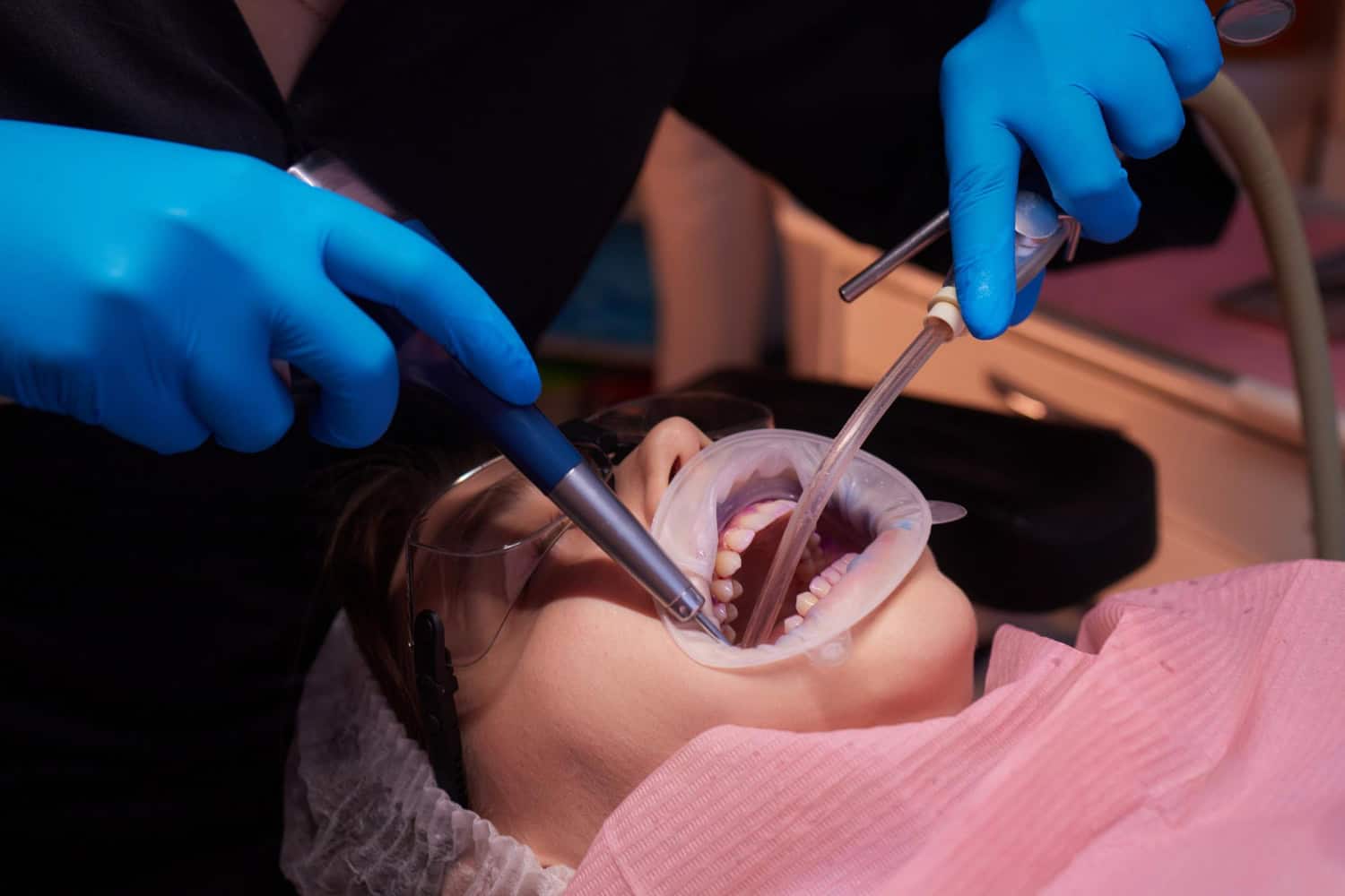Dentist performing dental bonding treatment with instruments to restore and improve a patient’s damaged tooth.