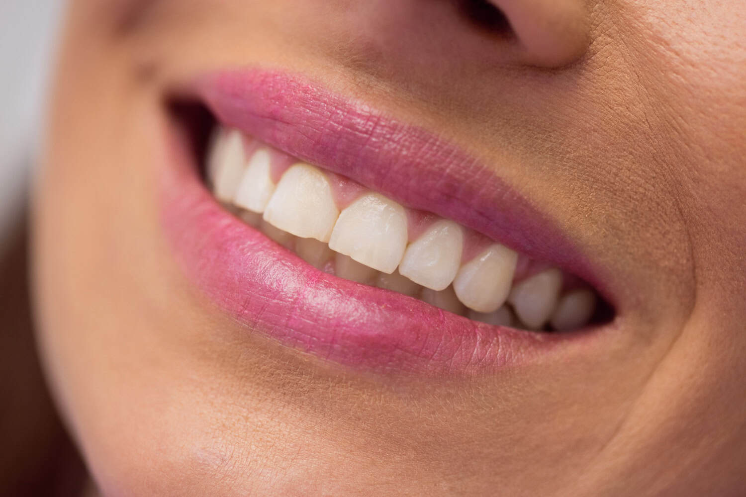 Close-up of a healthy, natural-looking smile with clean, evenly shaped teeth.